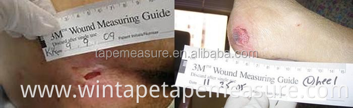 Custom wound measuring ruler